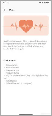 Característica ECG filtrada en OnePlus Watch 3
